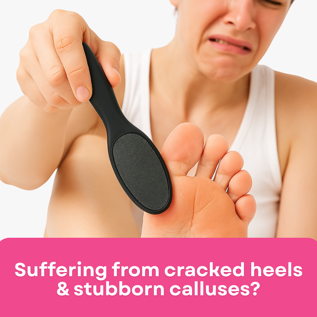 Nova Glo Series 3 - Callus Remover